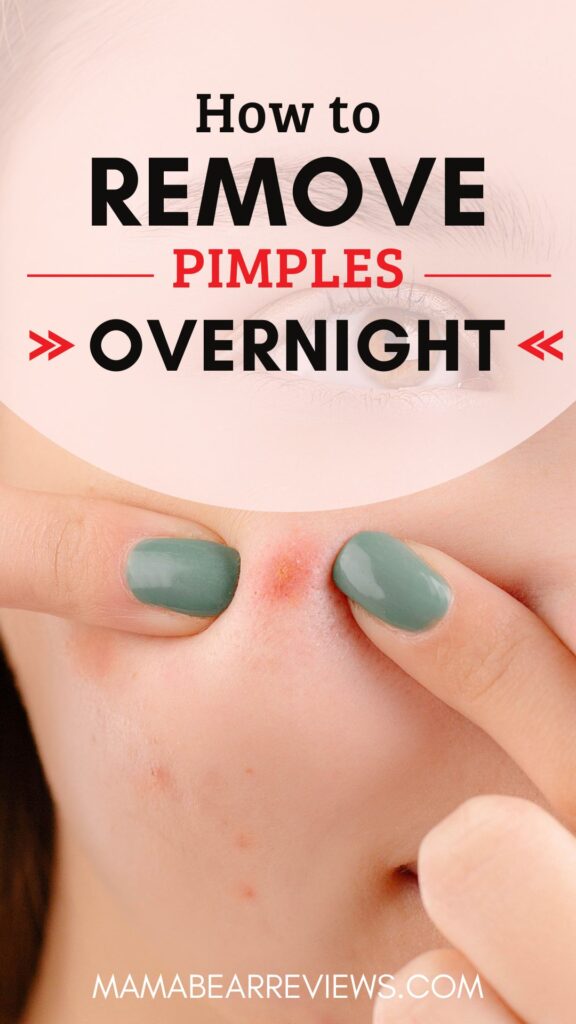 how to remove pimple overnight